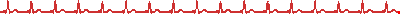 KXgXQO7.gif