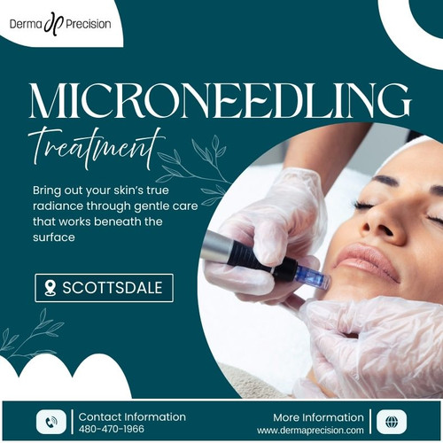 Microneedling in Scottsdale.jpg