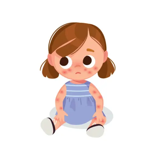 depositphotos 388989786 stock illustration baby girl skin problem allergic.webp