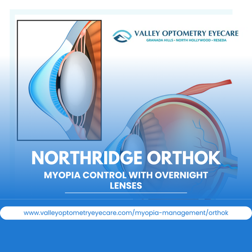 Northridge OrthoK – Myopia Control with Overnight Lenses.png