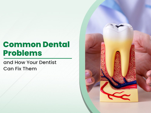 Common Dental Problems and How Your Dentist Can Fix Them.jpg