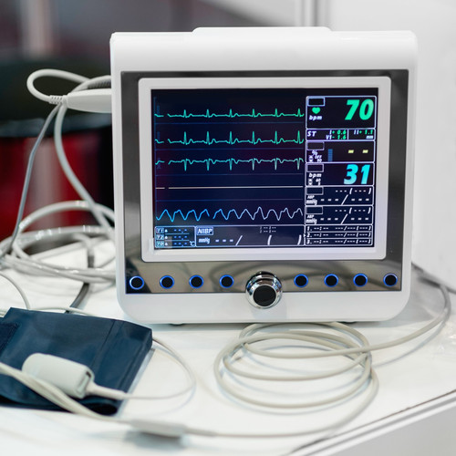 Affordable ECG Scan Cost in T. Nagar | Primex Healthcare.jpg