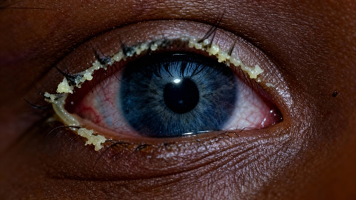 04 infected a 20 year old Ethiopian woman with dark smooth skin dark slate blue.jpg
