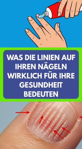 FVX (32).jpg