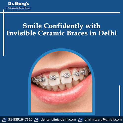 Smile Confidently with Invisible Ceramic Braces in Delhi.jpg