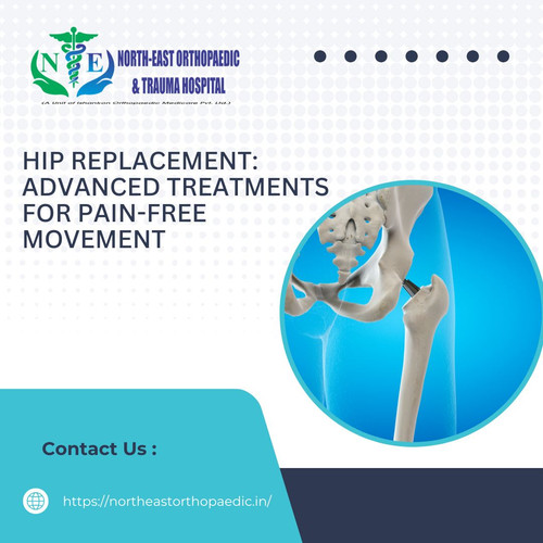Hip Replacement: Advanced Treatments for Pain-Free Movement.jpg