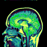 Animated gif cat scan picture moving.gif