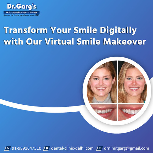 Transform Your Smile Digitally with Our Virtual Smile Makeover.jpg