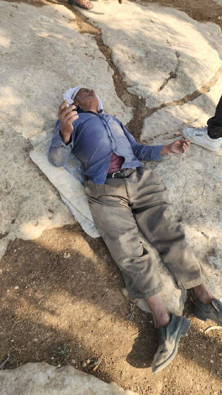 بطش مستمر بحق الأهالي والمزارعين! متابعة| إصابة مسن في اعتداء المستوطنين على الأهالي في خربة شعب البطم بمسافر يطا جنوب الخليل...