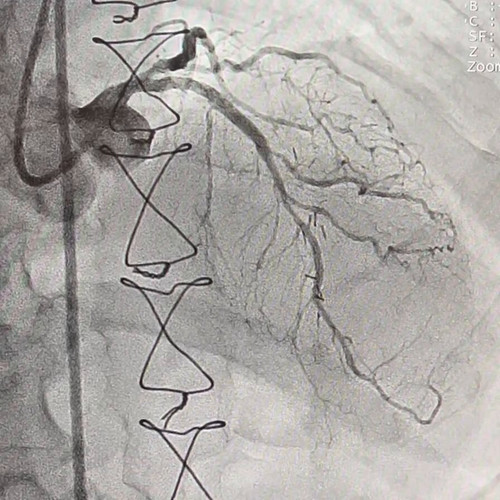 knek0yDB eNpz 0w.jpg