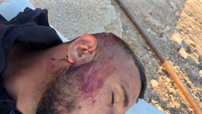 إصابات في صفوف الأهالي بقرية أم الخير جنوب الخليل جراء هجوم نفذه مستوطنون....