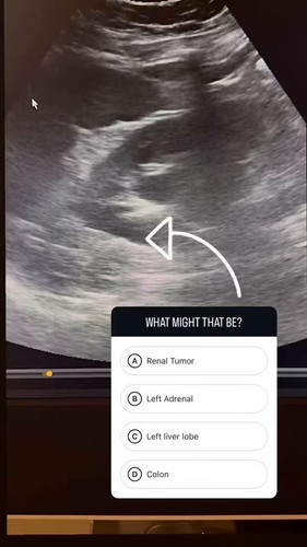 l5Ob zr6B3TArHQA.jpg