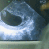 FwiRakV.gif