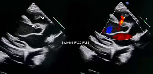 RHGNZ ssRLNOhRuu.jpg