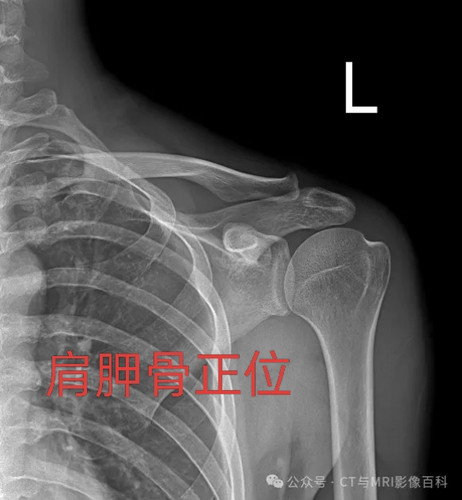 IMG 20251109 074851.jpg