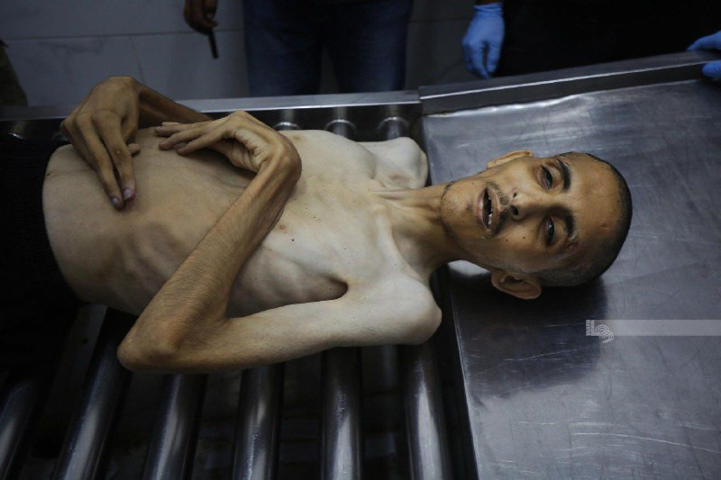 غزة: تم تشييع جثمان الشاب حمادة نائل ورش آغا (28 عامًا) في مستشفى الشفاء الطبي بعد وفاته نتيجة لسوء التغذية الحاد....