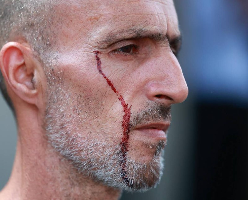 تعرض شاب فلسطيني لإصابات بعد أن اعتدى عليه جنود الاحتلال إثر رفضه بيع جنود الاحتلال مشروبات باردة خلال اقتحام وسط رام الله....