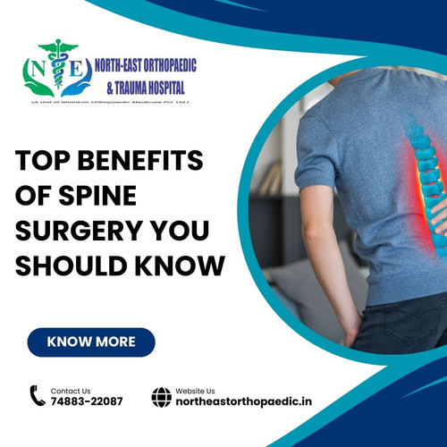 Top Benefits of Spine Surgery You Should Know.jpg