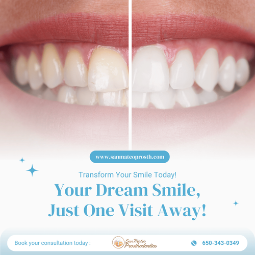 Restorative Dentistry San Mateo.png