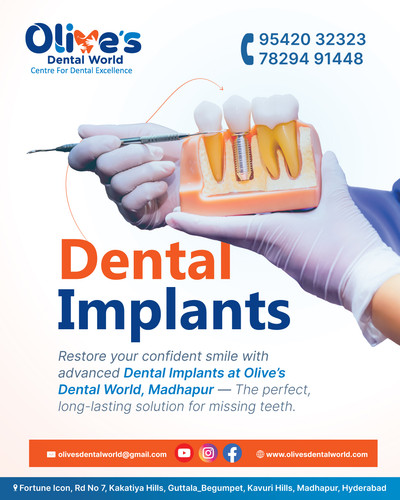 What to Expect During a Dental Implant Procedure?.jpg