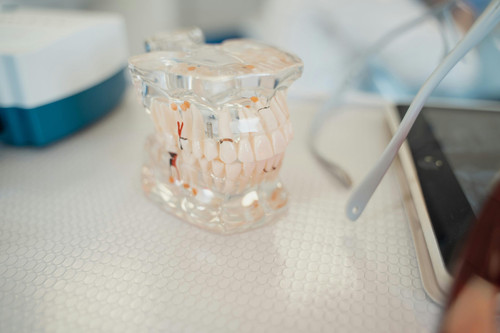 Composite Fillings San Mateo.jpg