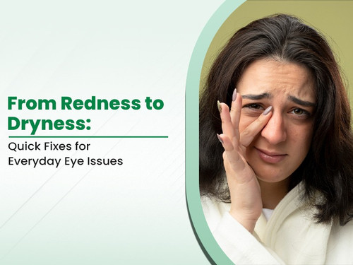 From Redness to Dryness Quick Fixes for Everyday Eye Issues.jpg