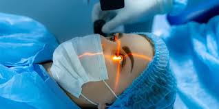 Eye Lens Replacement Surgery at Harley Vision Laser Eye Clinic– Clear Vision for Life.jpg