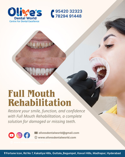 How Dentists Perform Full Mouth Rehabilitation Step by Step?.jpg