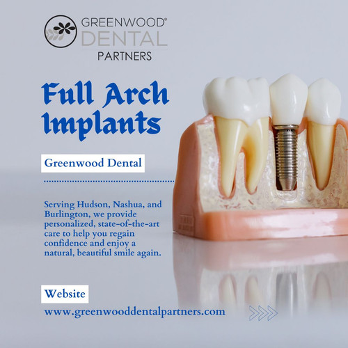Full Arch Implants Complete Smile Restoration by Greenwood Dental Partners.jpg