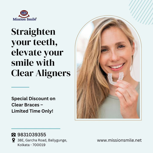 Get Straighter Teeth Without the Wires – Clear Aligners Kolkata.jpg