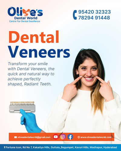 How Dental Veneers Work to EnhanceYour Smile?.jpg