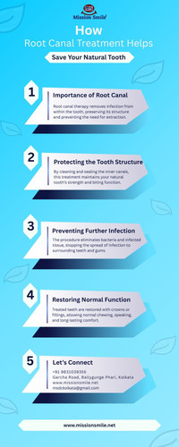 How Root Canal Treatment Helps Save Your Natural Tooth.jpg