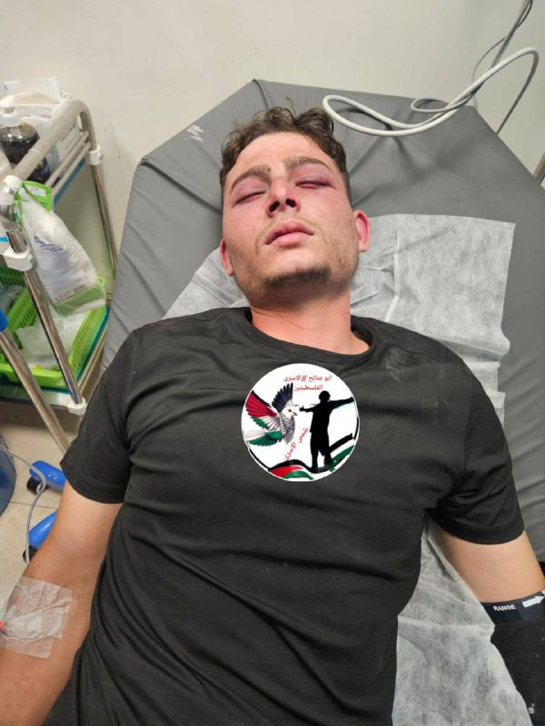 اعتقلت قوات الاحتلال الشاب مهند عيساوي دويكات من بيتا جنوب نابلس، وهو أسير سابق، على حاجز زعترة، واعتدت عليه بالضرب المبرح، وصادرت هويته وهاتفه. وتم إ...