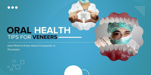 Oral Health Tips for Veneers (and What to Know About Composite vs Porcelain).jpg