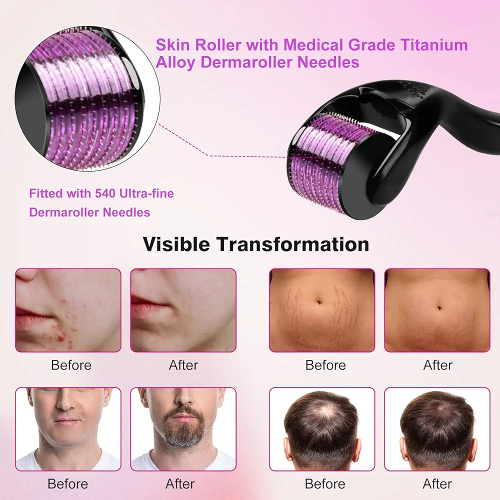 Derma Roller - DRS Image 5