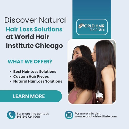 Discover Natural Hair Loss Solutions at World Hair Institute Chicago.jpg
