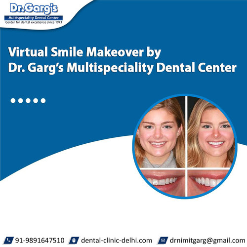 Virtual Smile Makeover by Dr. Garg’s Multispeciality Dental Center.jpg