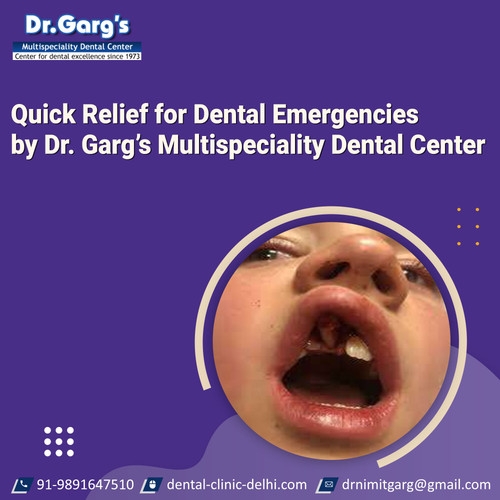 Quick Relief for Dental Emergencies by Dr. Garg’s Multispeciality Dental Center.jpg