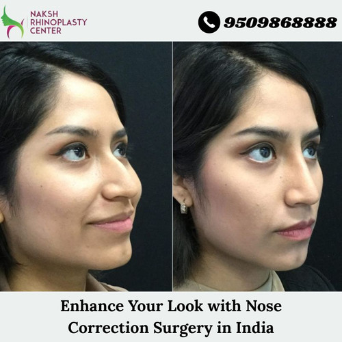 Enhance Your Look with Nose Correction Surgery in India.jpg