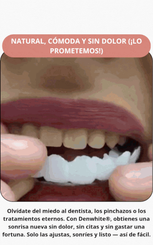 LP mexico facetas dental.gif