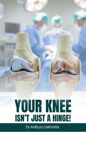 Your Knee A Complex Joint Deserving Proper Care.jpg