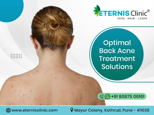 skin allergies Treatment in pune (3).jpg