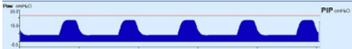 waveform 1.png
