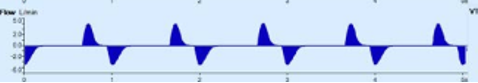 Decelerating waveform.png