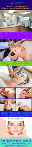 Cosmetic Acupuncture In Albuquerque Endpoint Wellness.png