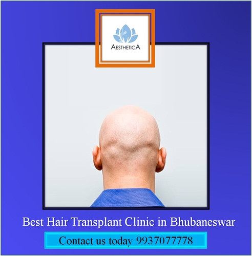 Best Hair Transplant Clinic in Bhubaneswar.jpg