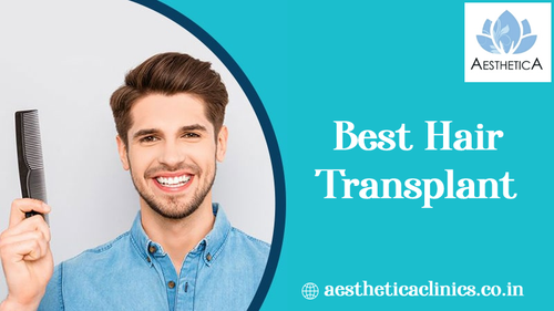 Best Hair Transplant Clinic in India.png