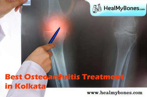 Heal My Bones: Most Effective Treatment for Osteoarthritis in Kolkata.jpg