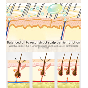 africa hair loss treatment of traction alopecia super fast hair growth shampoo 18.jpg