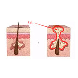 africa hair loss treatment of traction alopecia super fast hair growth shampoo 15